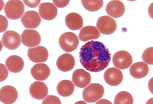 Анализ крови на эозинофилы: норма, повышенный уровень, содержание