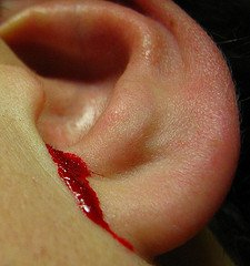 Что делать, если течёт кровь из уха?.