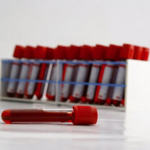 Лимфоциты в анализе крови ребенка: норма количества, анализы, причины снижения уровня