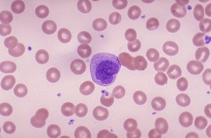 Повышенные моноциты в крови у ребенка: причины, норма содержания, анализы. Что это означает при беременности
