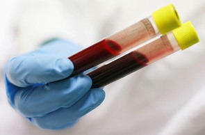 Повышенный белок в крови: причины и лечение