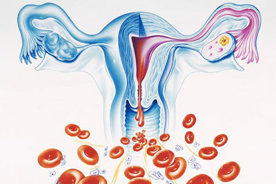 Жжение у женщин после менструации thumbnail