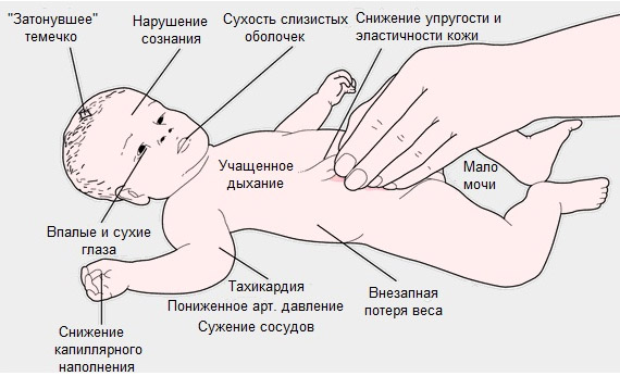 Ребенку 11 месяцев понос без температуры thumbnail