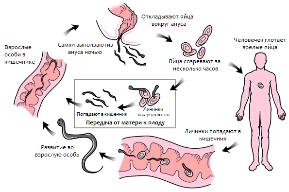 пути передачи энтеробиоза